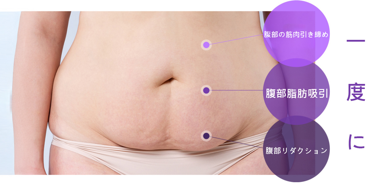모델