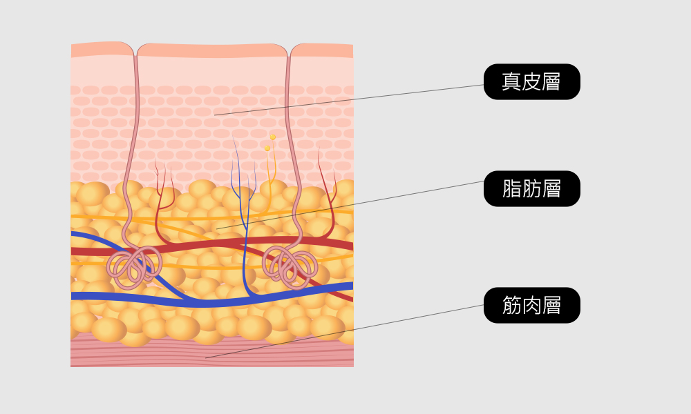모델