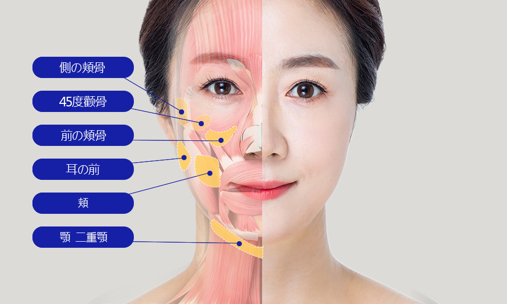 모델