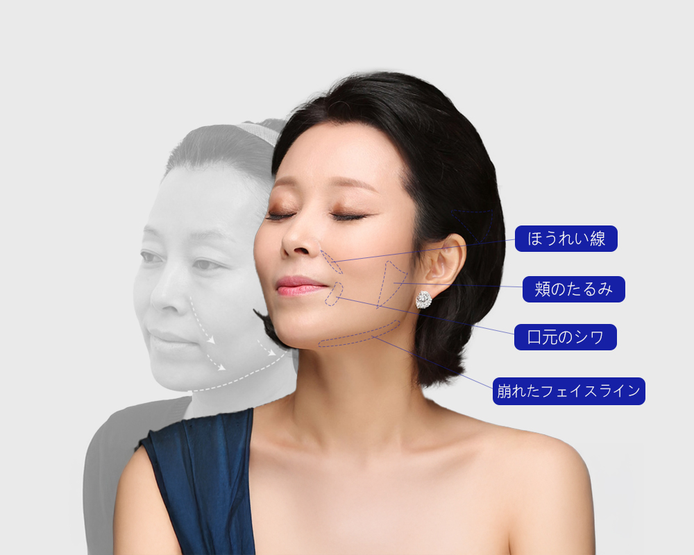 모델