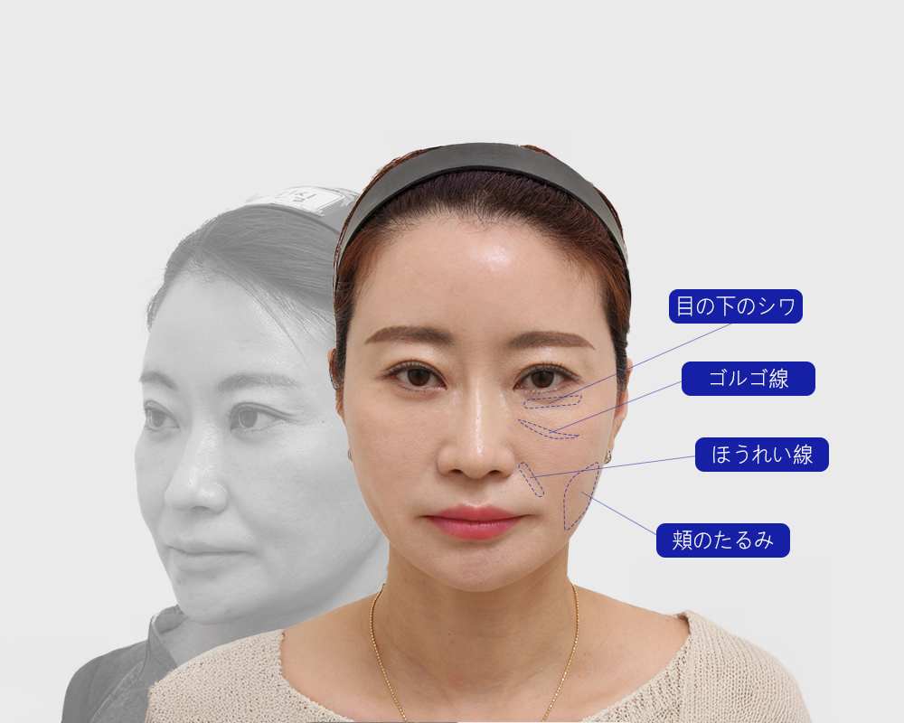 모델