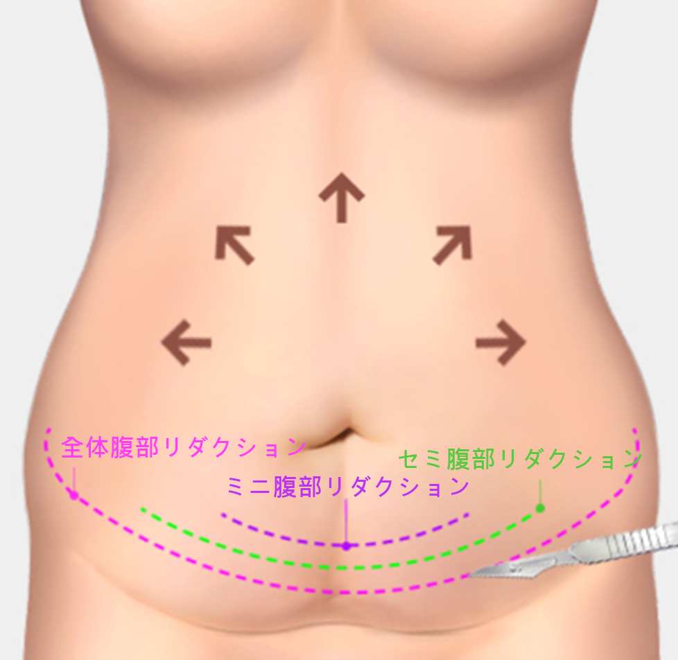 모델