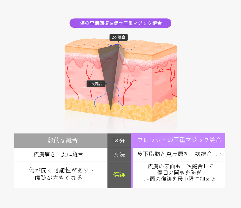 腹部リダクション