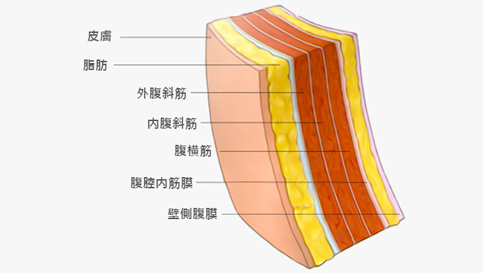 모델