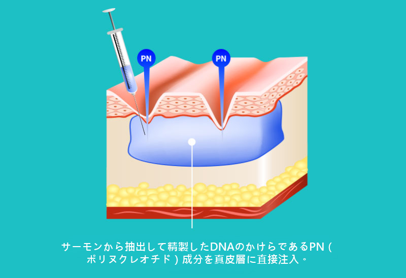 모델