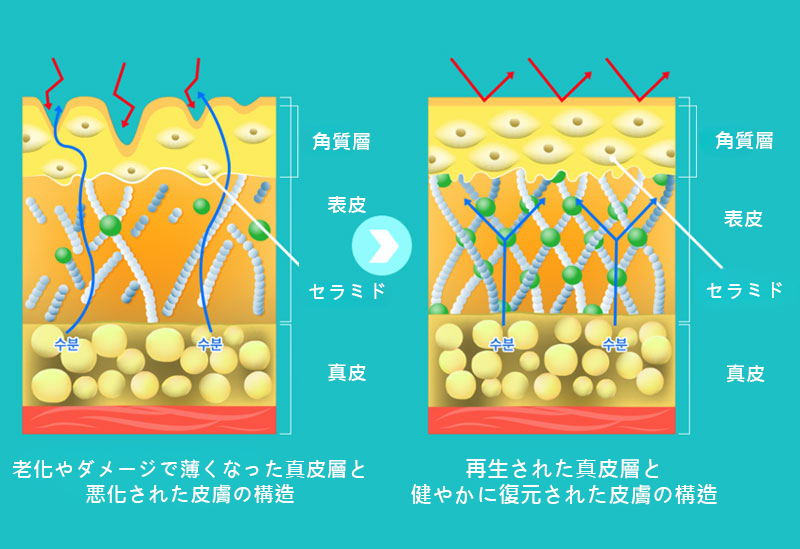 모델