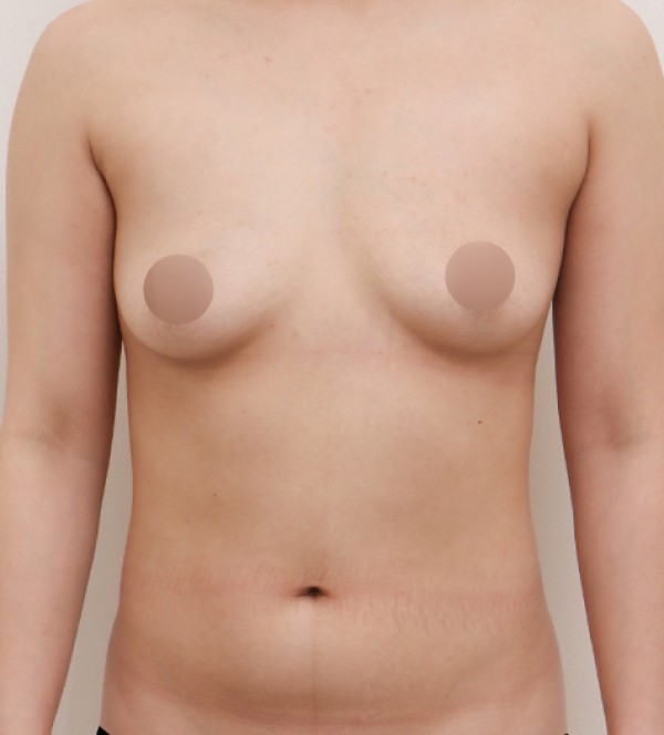 ハーベストジェッ…