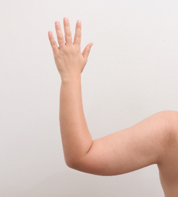 ベイザー2ボディ…