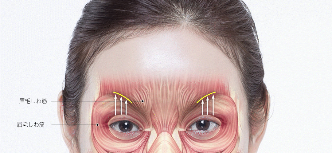 脂肪過剰注入、異物除去